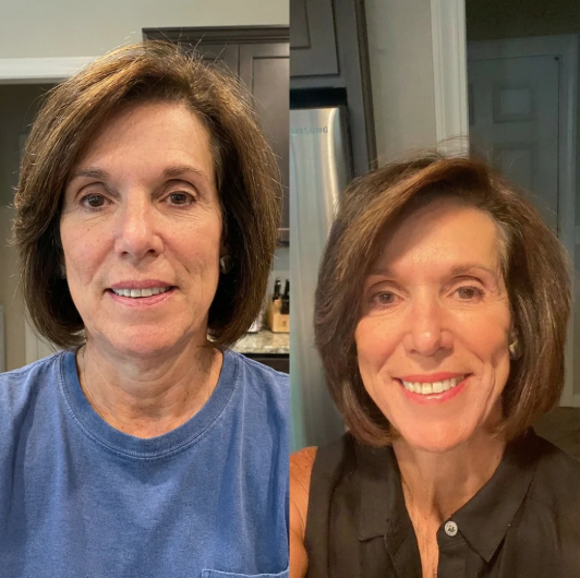 <p><strong>Gel Strips</strong></p>