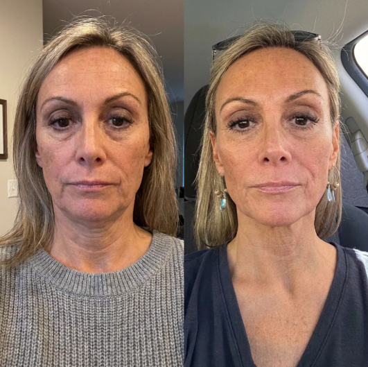 <p><strong>Nail Care</strong></p>